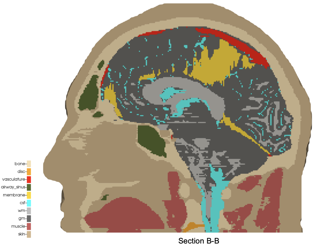 fig/sibl_bob_mid-sagittal.png