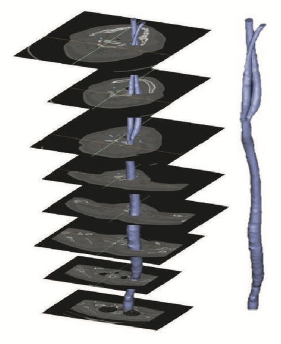 fig/stack_reconstruction.png